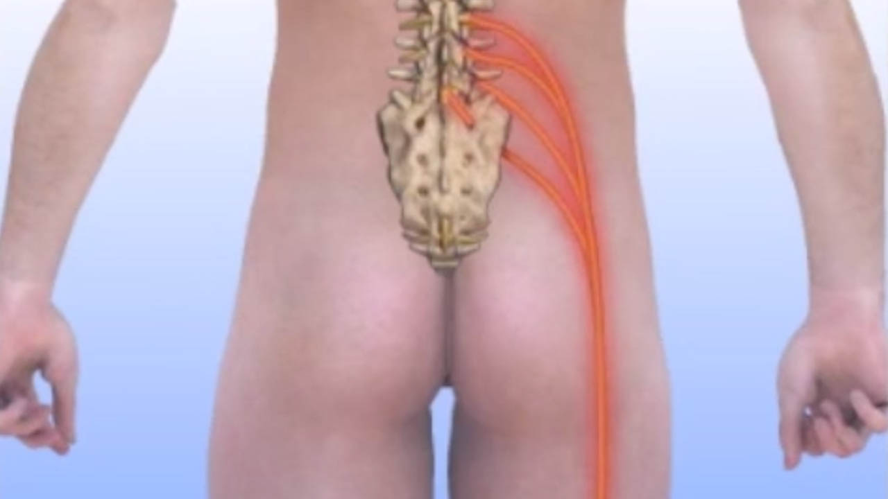 Sciatic nerve anatomy