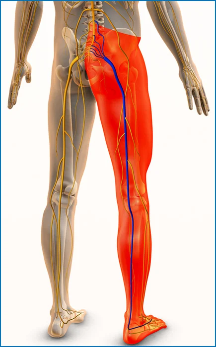 Nerve inflammation