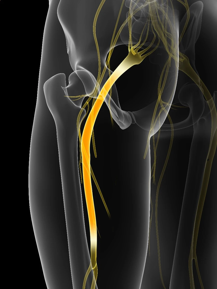 Sciatic nerve